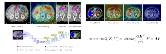 U-Transformer graphical absract